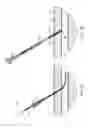 Fig. 08 - Catheter with sealed hydratable hemostatic occlusion element