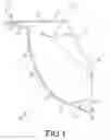 Fig. 02 - Tissue specimen retrieval bag, method for retrieving tissue