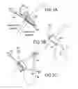 Fig. 04 - Tissue specimen retrieval bag, method for retrieving tissue