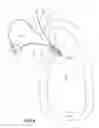 Fig. 05 - Knotless self-locking anchor constructs and methods of tissue fixation