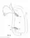 Fig. 06 - Knotless self-locking anchor constructs and methods of tissue fixation