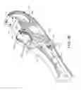 Fig. 11 - Suturing device for minimally invasive surgery