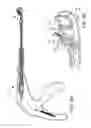 Fig. 12 - Suturing device for minimally invasive surgery