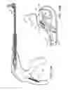 Fig. 18 - Suturing device for minimally invasive surgery