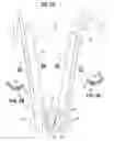 Fig. 04 - Transcatheter heart valve leaflet plication