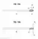 Fig. 11 - Transcatheter heart valve leaflet plication