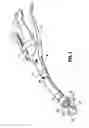 Fig. 05 - Surgical instruments including MEMS devices