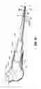 Fig. 11 - Surgical instruments including MEMS devices