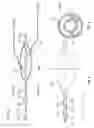 Fig. 04 - System and method for treating heart tissue