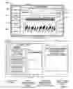 Fig. 06 - System and method for treating heart tissue