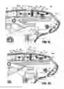 Fig. 06 - Endoscopic surgical clip applier