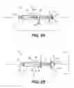 Fig. 03 - Stone capture devices and methods
