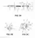 Fig. 04 - Stone capture devices and methods
