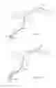 Fig. 08 - Retrieval systems and methods for use thereof