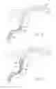 Fig. 09 - Retrieval systems and methods for use thereof