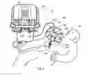 Fig. 02 - Sealing multiple surgical instruments