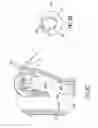 Fig. 31 - Sealing multiple surgical instruments