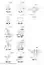 Fig. 06 - IMPLANT AND METHOD FOR FACET IMMOBILIZATION