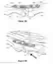 Fig. 07 - Compression plate kit and methods for repairing bone discontinuities
