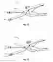Fig. 09 - Compression plate kit and methods for repairing bone discontinuities