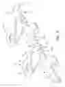 Fig. 03 - Maxillomandibular fixation devices