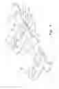 Fig. 04 - Maxillomandibular fixation devices