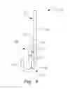Fig. 05 - Maxillomandibular fixation devices