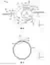 Fig. 02 - Tensioning cable locking device