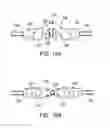 Fig. 07 - Ablation catheter system with safety features
