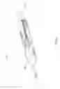 Fig. 03 - Medical device balloon