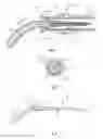 Fig. 02 - Microwave ablation device