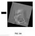 Fig. 16 - System and method for providing surgical guidance based on polarization-sensitive optical coherence tomography