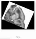 Fig. 19 - System and method for providing surgical guidance based on polarization-sensitive optical coherence tomography