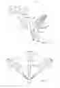 Fig. 06 - Curved cannula surgical system control