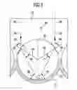 Fig. 04 - SURGICAL MARKER ELEMENT, SURGICAL REFERENCING UNIT, AND SURGICAL NAVIGATION SYSTEM