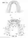 Fig. 02 - Orthodontic assembly