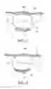 Fig. 07 - Orthodontic assembly