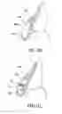 Fig. 08 - Orthodontic assembly