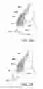 Fig. 09 - Orthodontic assembly
