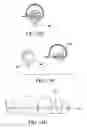 Fig. 35 - Orthodontic assembly