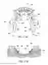 Fig. 46 - Orthodontic assembly