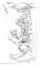 Fig. 04 - ORTHODONTIC BRACKET ASSEMBLIES WITH TORQUE-ADJUSTING DRUMS