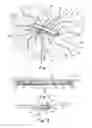 Fig. 02 - Prosthetic repair system and method of use