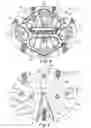 Fig. 03 - Prosthetic repair system and method of use