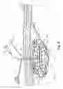 Fig. 05 - Prosthetic repair system and method of use