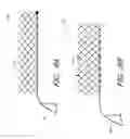 Fig. 09 - Percutaneous method and device to treat dissections