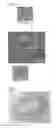 Fig. 02 - Artificial blood vessel, method for producing artificial blood vessel, and method for producing porous tissue regeneration substrate