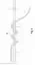 Fig. 08 - Self-locking suture constructs and methods of tissue fixation