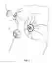 Fig. 02 - Cover device and method of applying cover device for constructing and protecting a nipple/areola complex