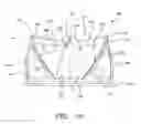 Fig. 02 - Vertical coaptation zone in a planar portion of prosthetic heart valve leaflet